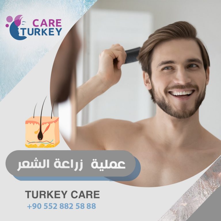 زراعة الشعر في تركيا