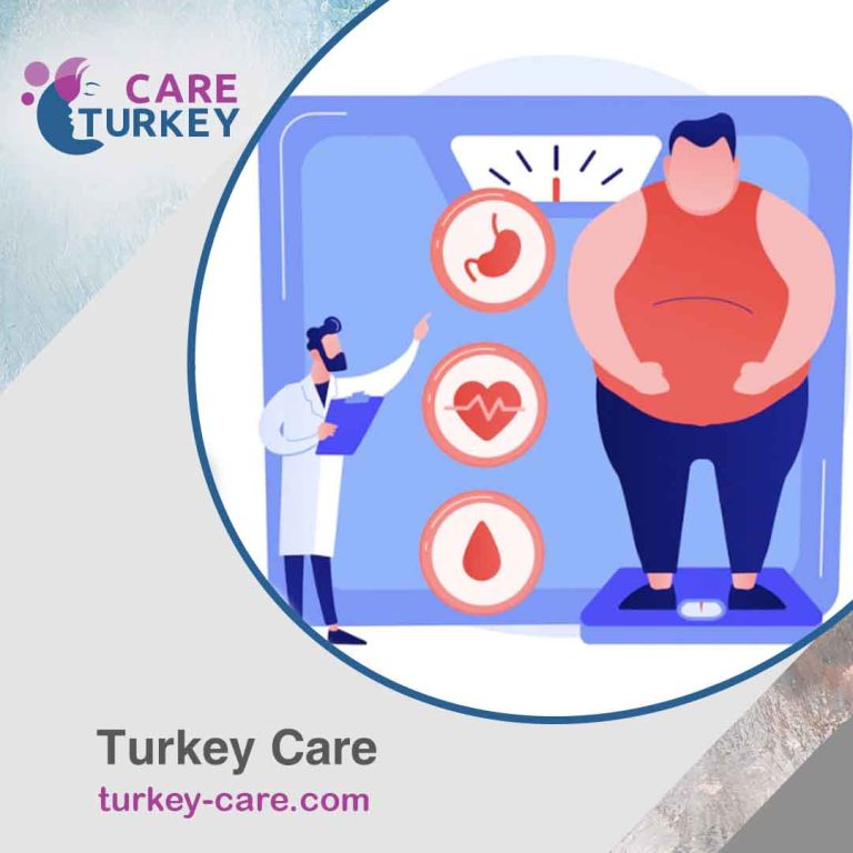 علاج السمنة في تركيا