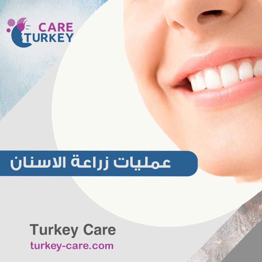 توركي كير - زراعة الاسنان الفورية في تركيا