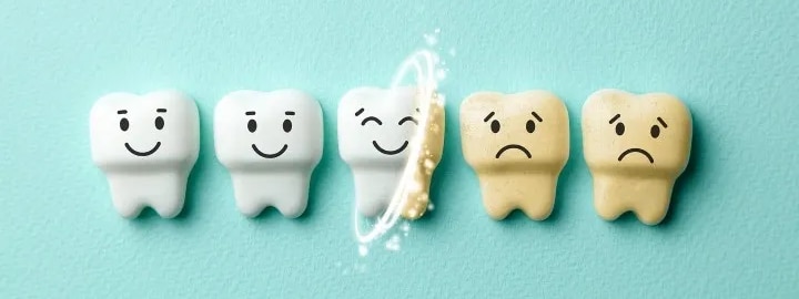 اسباب اصفرار الاسنان وحلولها - تبييض الاسنان