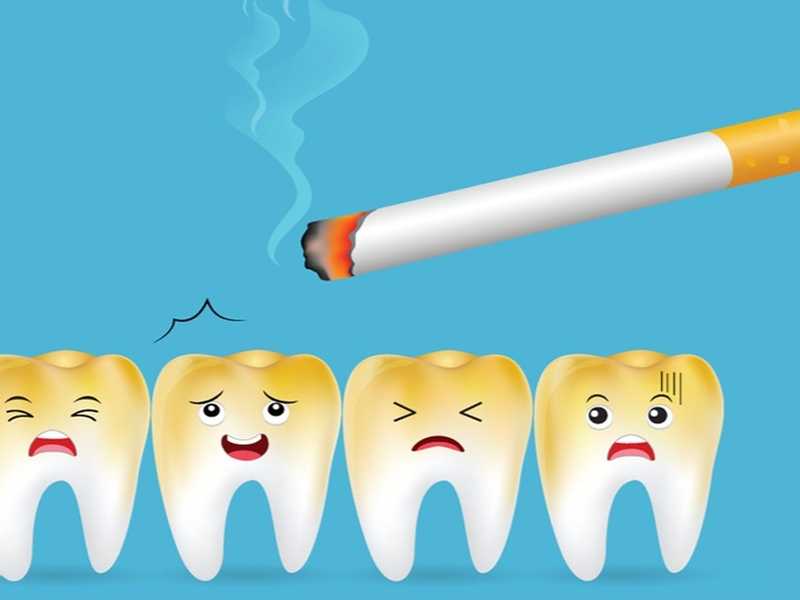 التدخين من أسباب اصفرار الأسنان