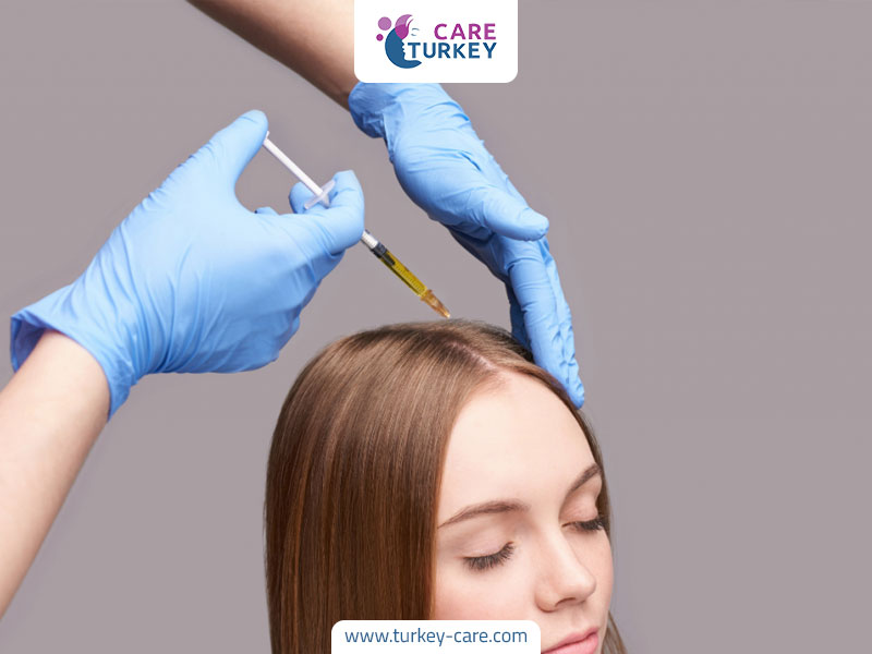 أفضل العيادات لزراعة الشعر-طريقة حقن البلازما لزراعة الشعر.