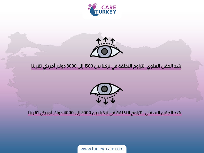 مقارنة بين تكاليف عملية شد الجفون العلوية و السفلية