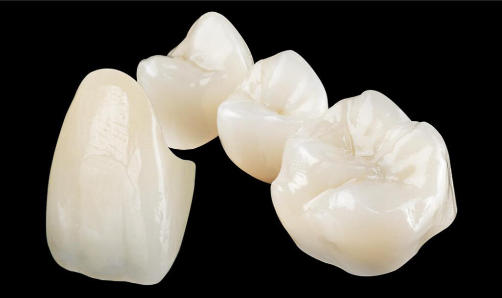 Zirconia Crown
