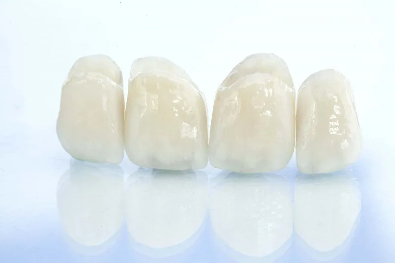 تاج السيراميك النقي (E-max)