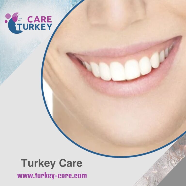 الابتسامة اللثوية