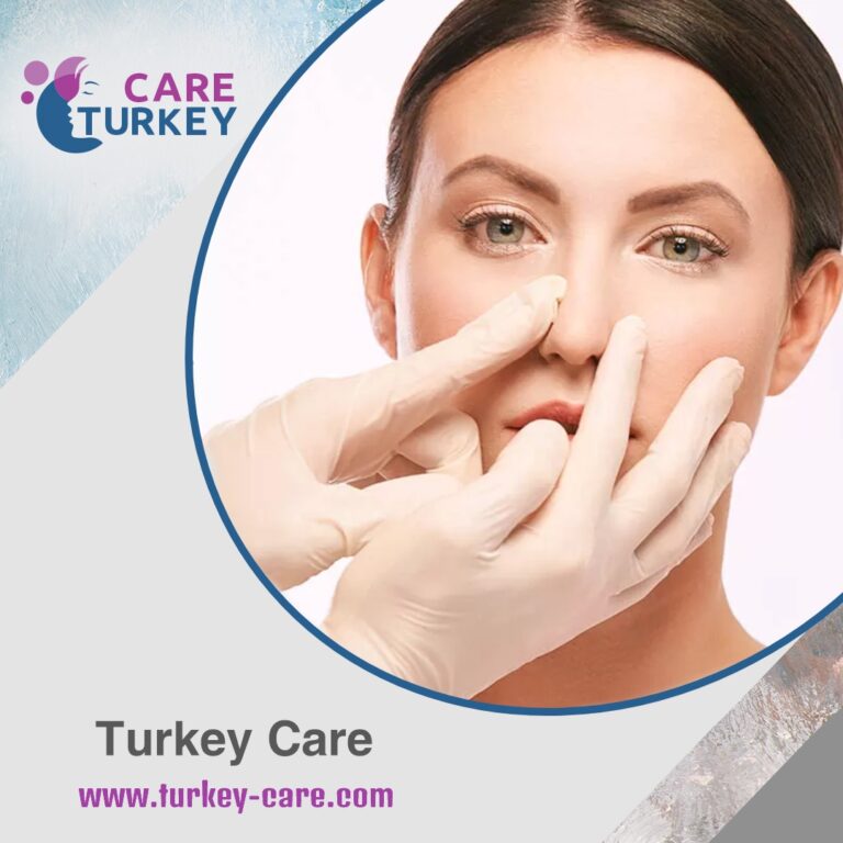 نحت عظمة الأنف