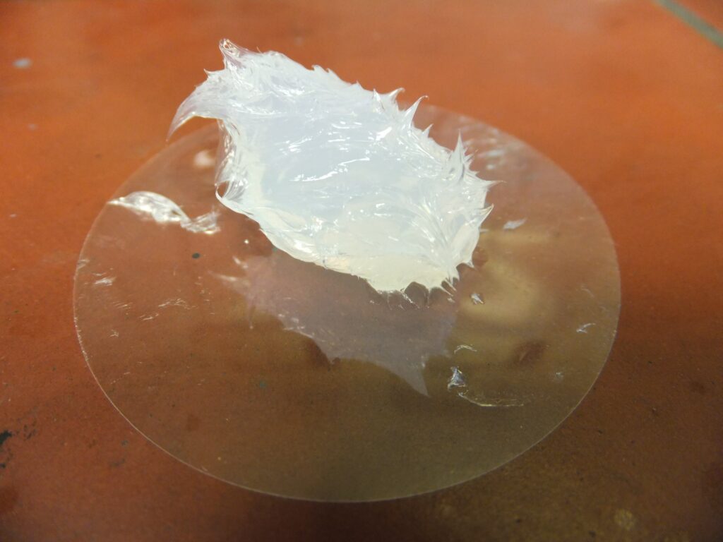 حقن السيليكون السائل أو بولي أكريلاميد في الخدين