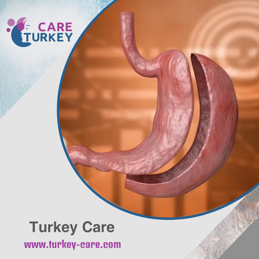 أضرار التكميم