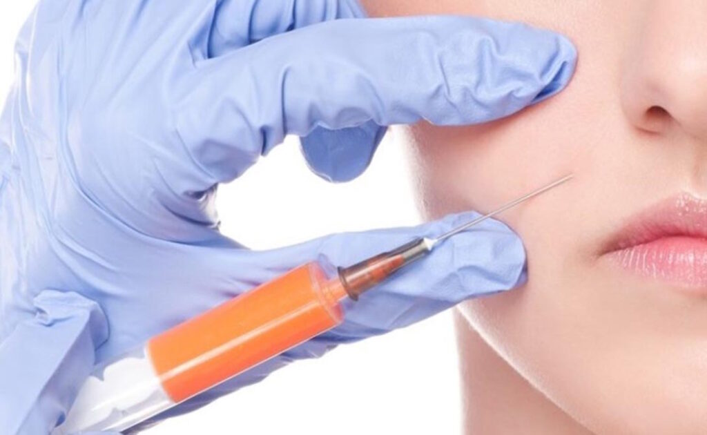 حقن الدهون الذاتية في الخدود