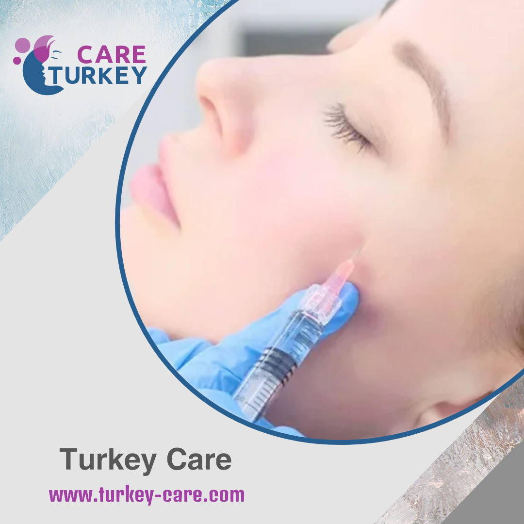 فلير الخدود