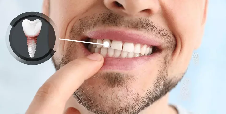 شخص مبتسم + أيقونات (ألم أقل، وقت أسرع، شفاء سريع).