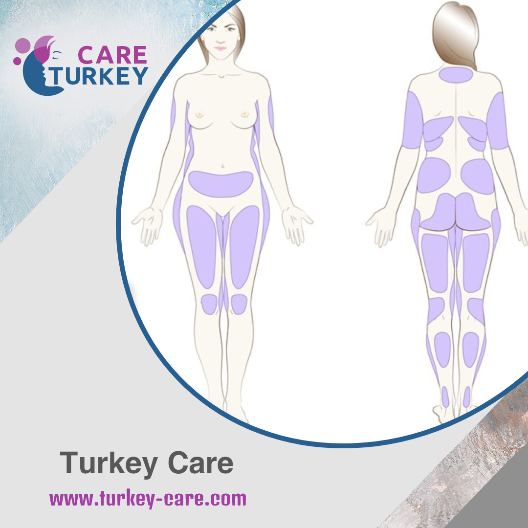 بقاء الدهون الذاتية في مناطق الجسم المختلفة