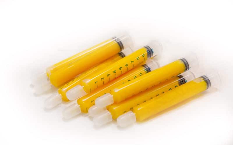 فيلر الدهون الذاتية (حقن الدهون)