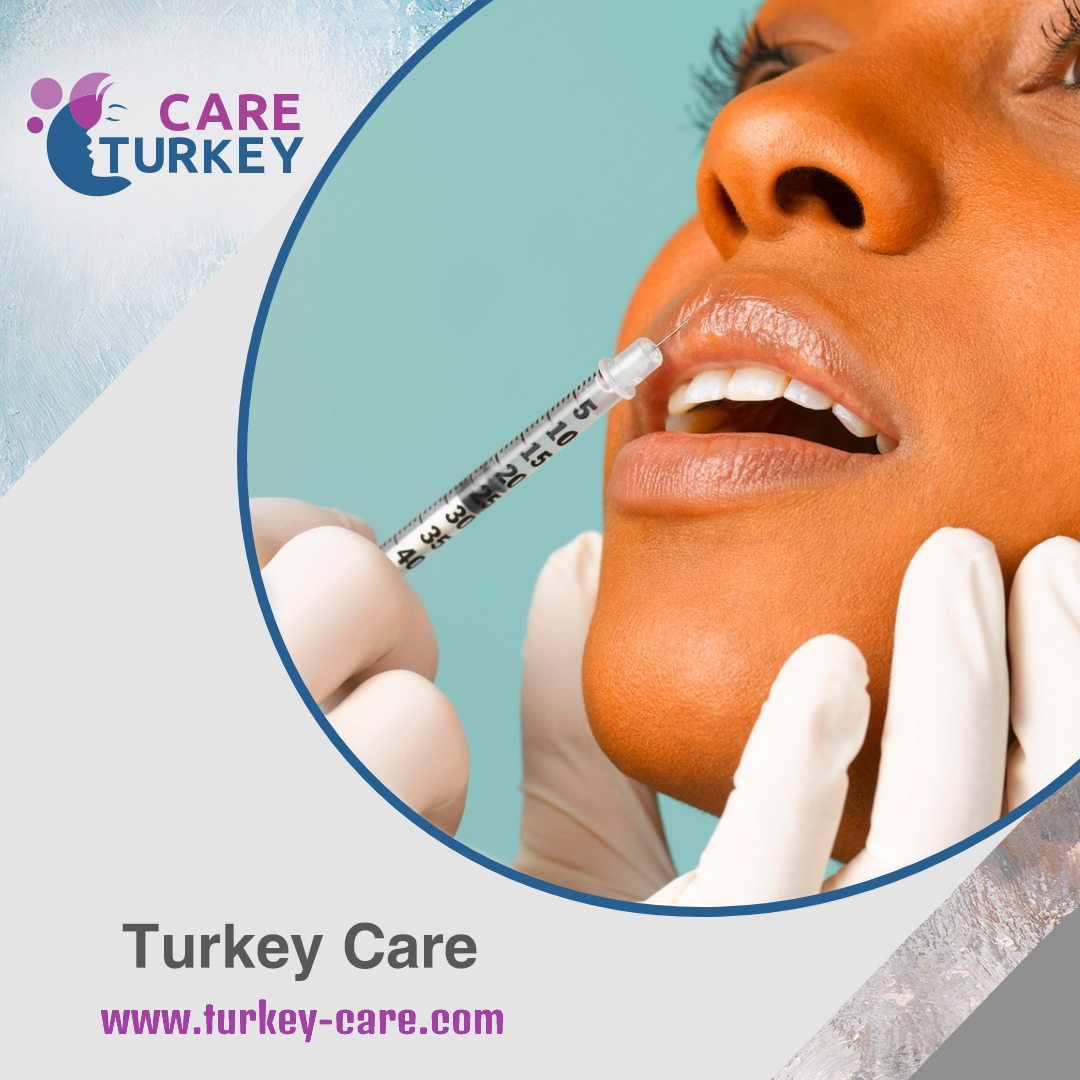 اذابة الفيلر