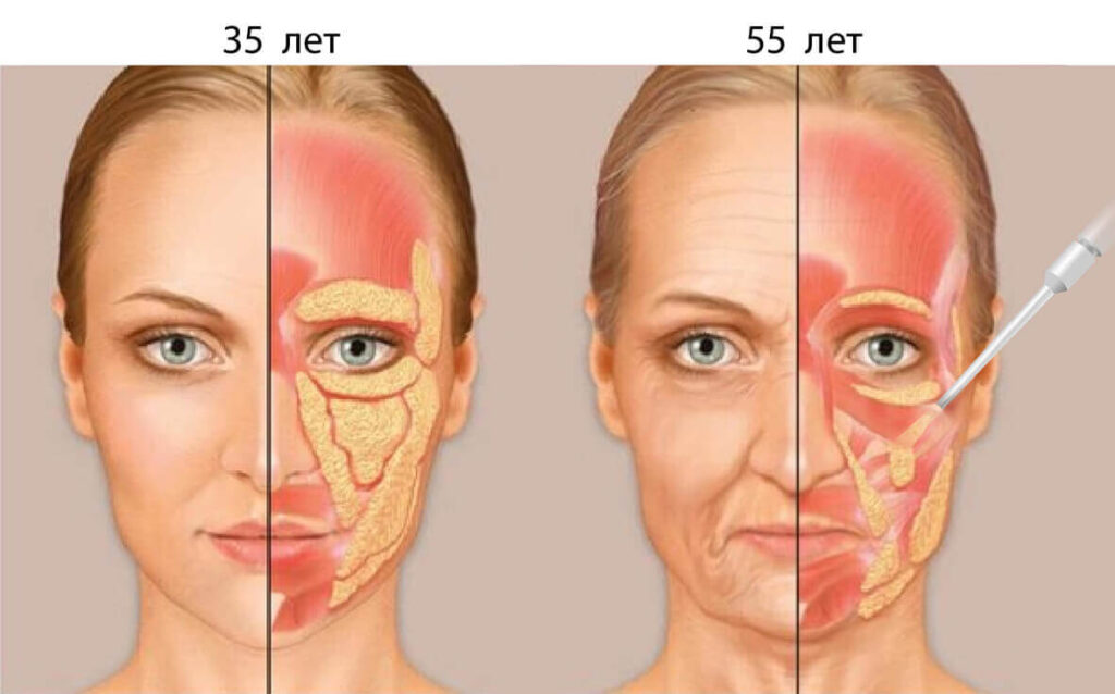 أبرز الاستخدامات الطبية والتجميلية لحقن الدهون الذاتية
