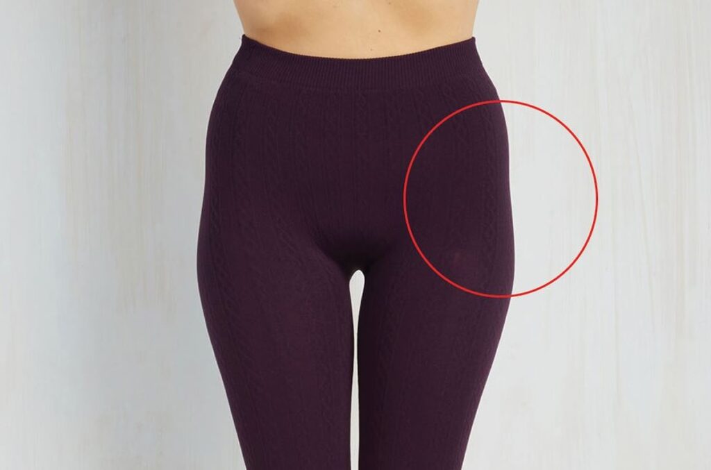 علاج الخفسة بالفلر