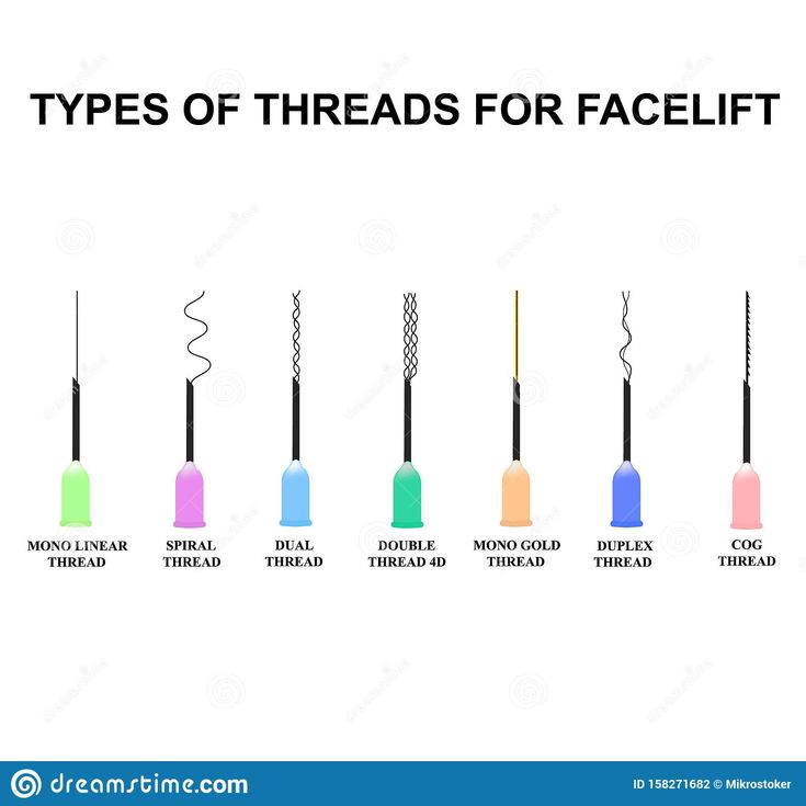 أنواع الخيوط المستخدمة بشد الرقبة