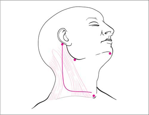 إنفوجرافيك يوضح أماكن الشقوق خلف الأذن وأسفل الفك.