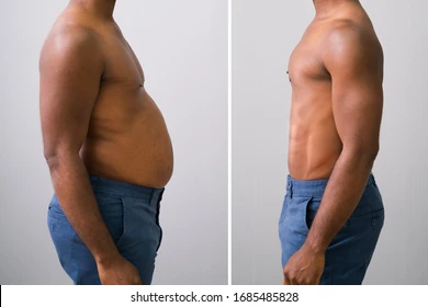 صورة قبل وبعد لامرأة أظهرت فرقًا واضحًا في محيط البطن والفخذين بعد الجلسات.