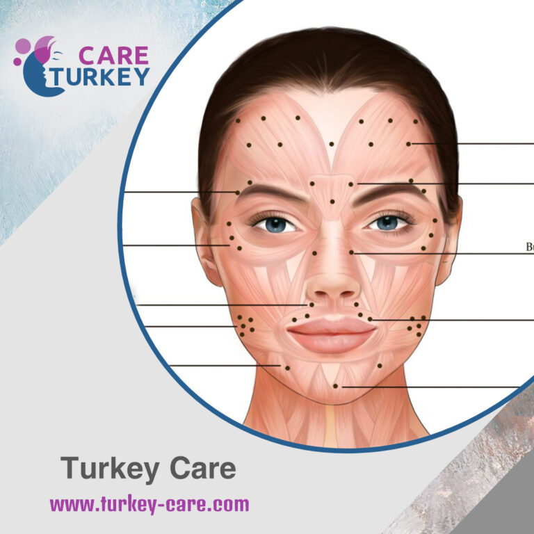 بوتوكس الجبهة