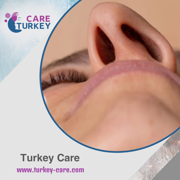 انحراف الحاجز الأنفي