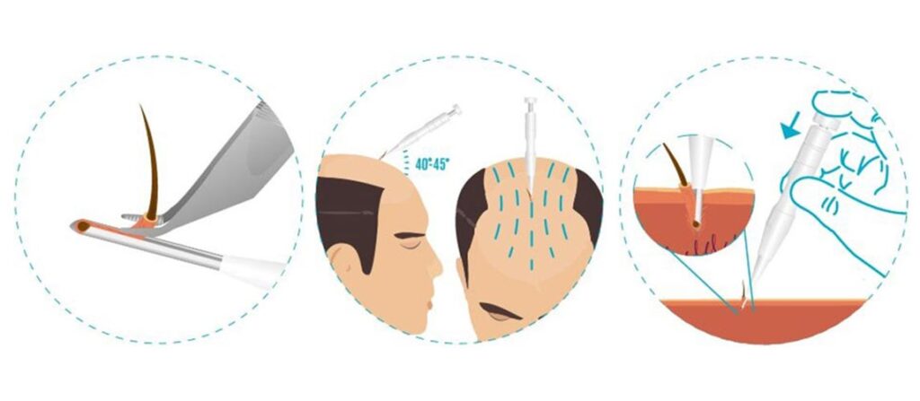 الفرق بين أقلام تشوي والسفير