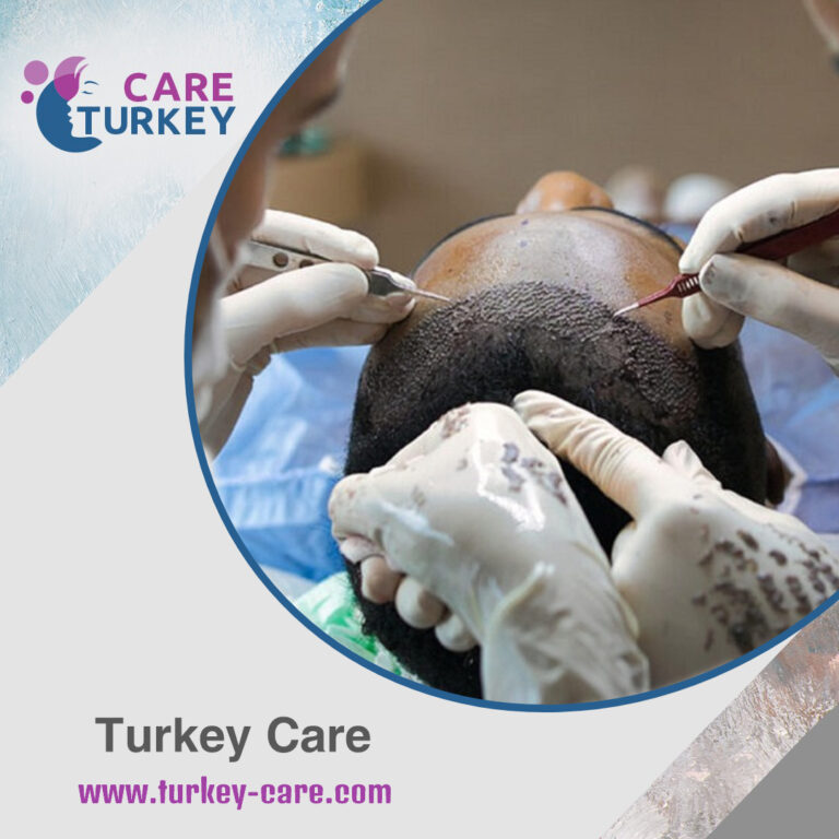 posthair-transplant-instructions