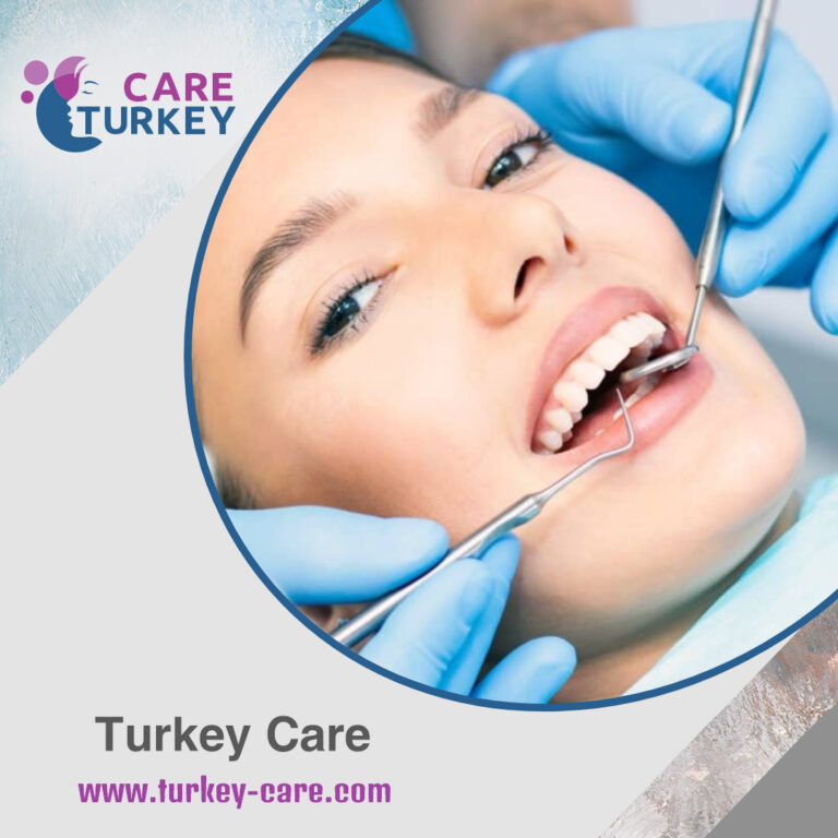 مدونة تجميل الاسنان في تركيا