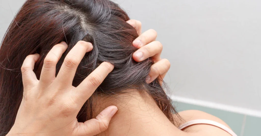 الوقت المناسب لزراعة الشعر-تاثير البيئة على زراعة الشعر