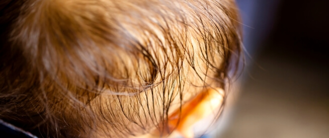 الوقت المناسب لزراعة الشعر