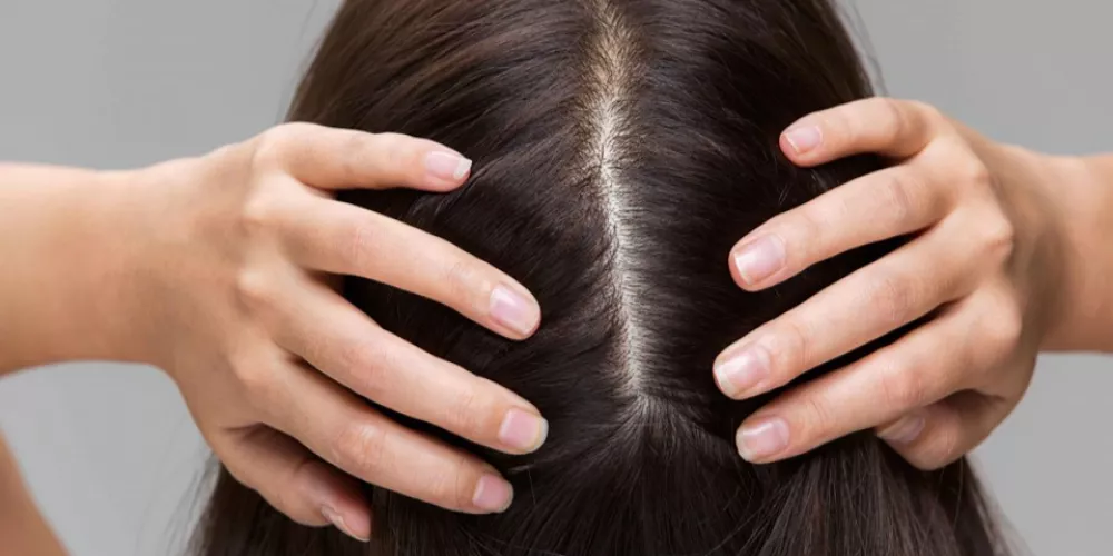 حالة فروة الرأس والصحة العامة
