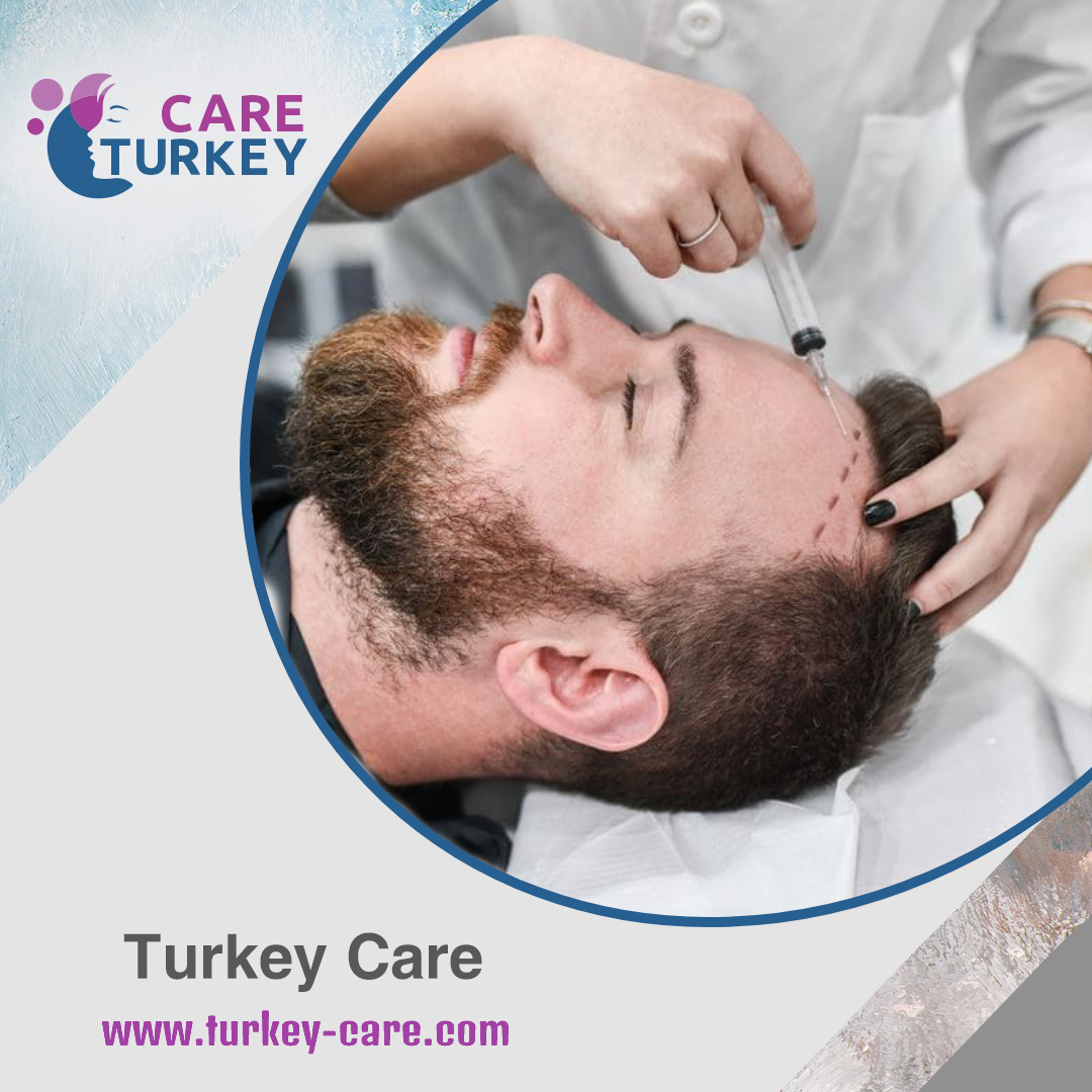 التخدير قبل زراعة الشعر