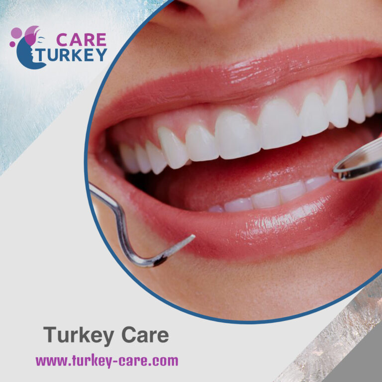 تبييض الأسنان في تركيا