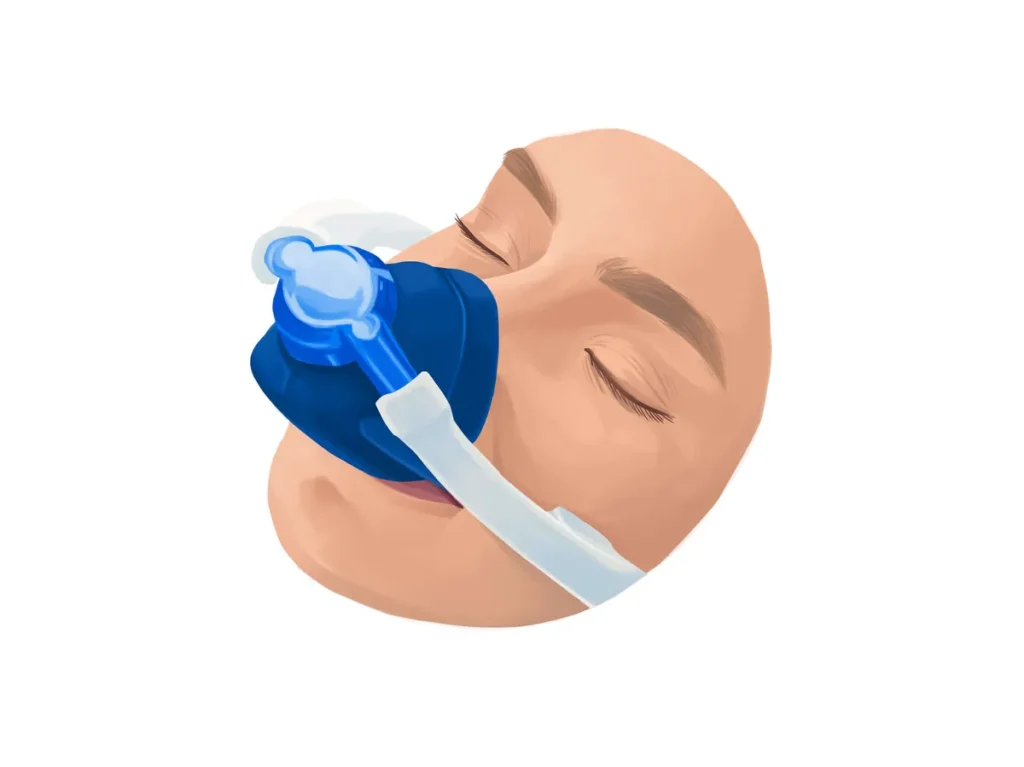 التخدير قبل زراعة الشعر