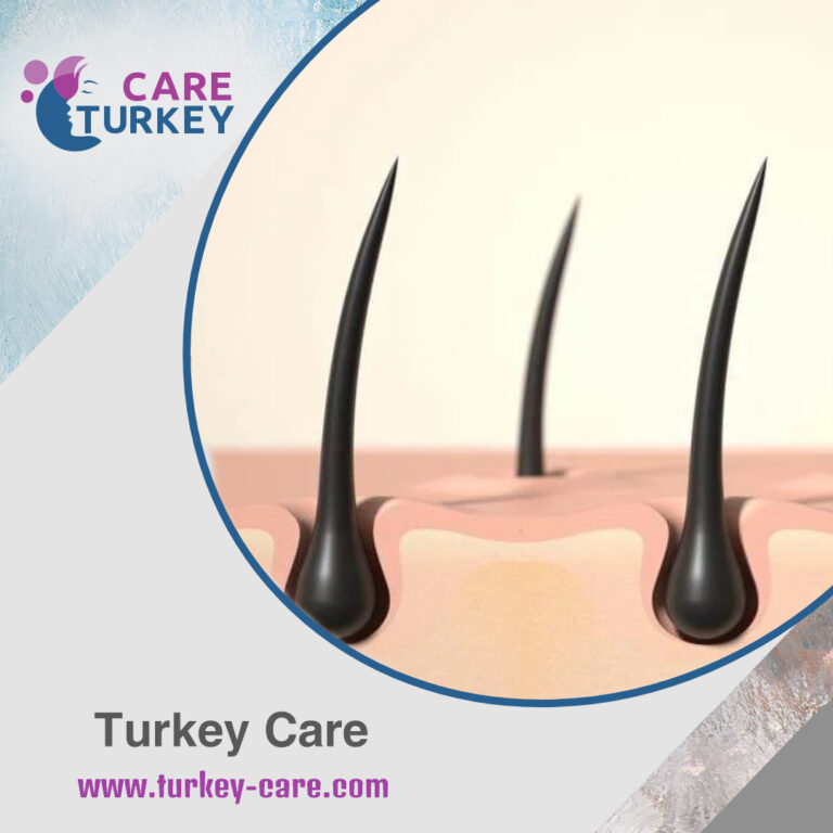 3D illustration showing the hair follicle structure and hair growth cycle, highlighting the role of nutrition.