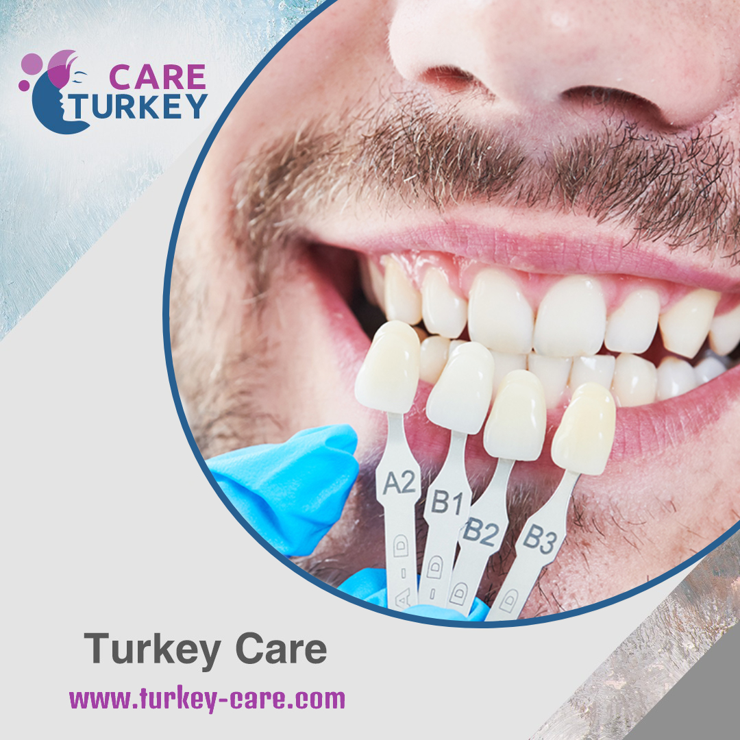 ابتسامة هوليوود للرجال في تركيا