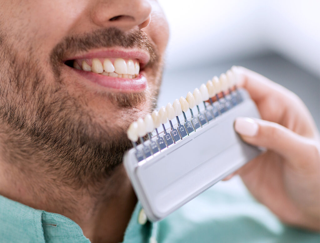 ابتسامة هوليوود للرجال في تركيا 