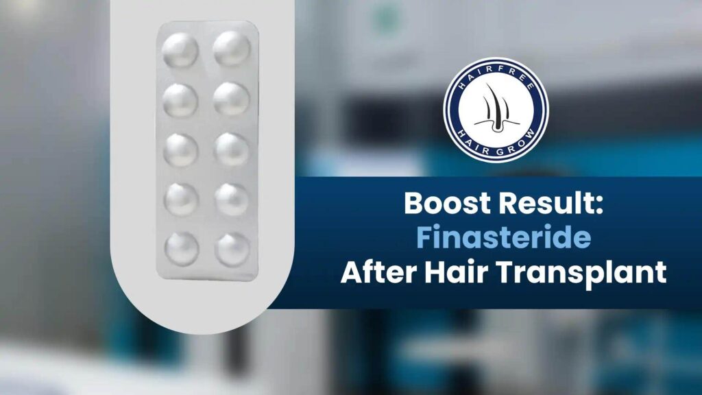 Finasteride بعد زراعة الشعر
