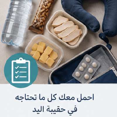 السفر بالطائرة بعد التكميم