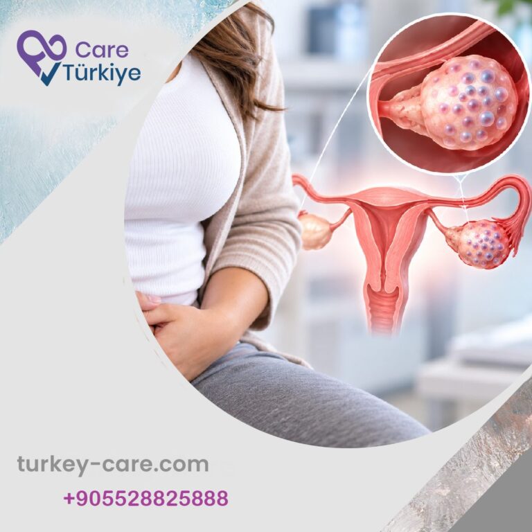 متلازمة تكيّس المبايض (PCOS) والسمنة