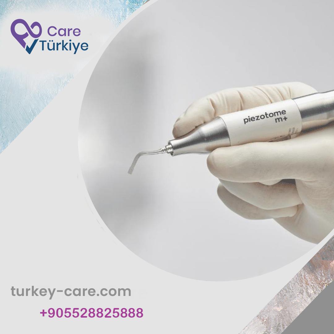 piezo rhinoplasty