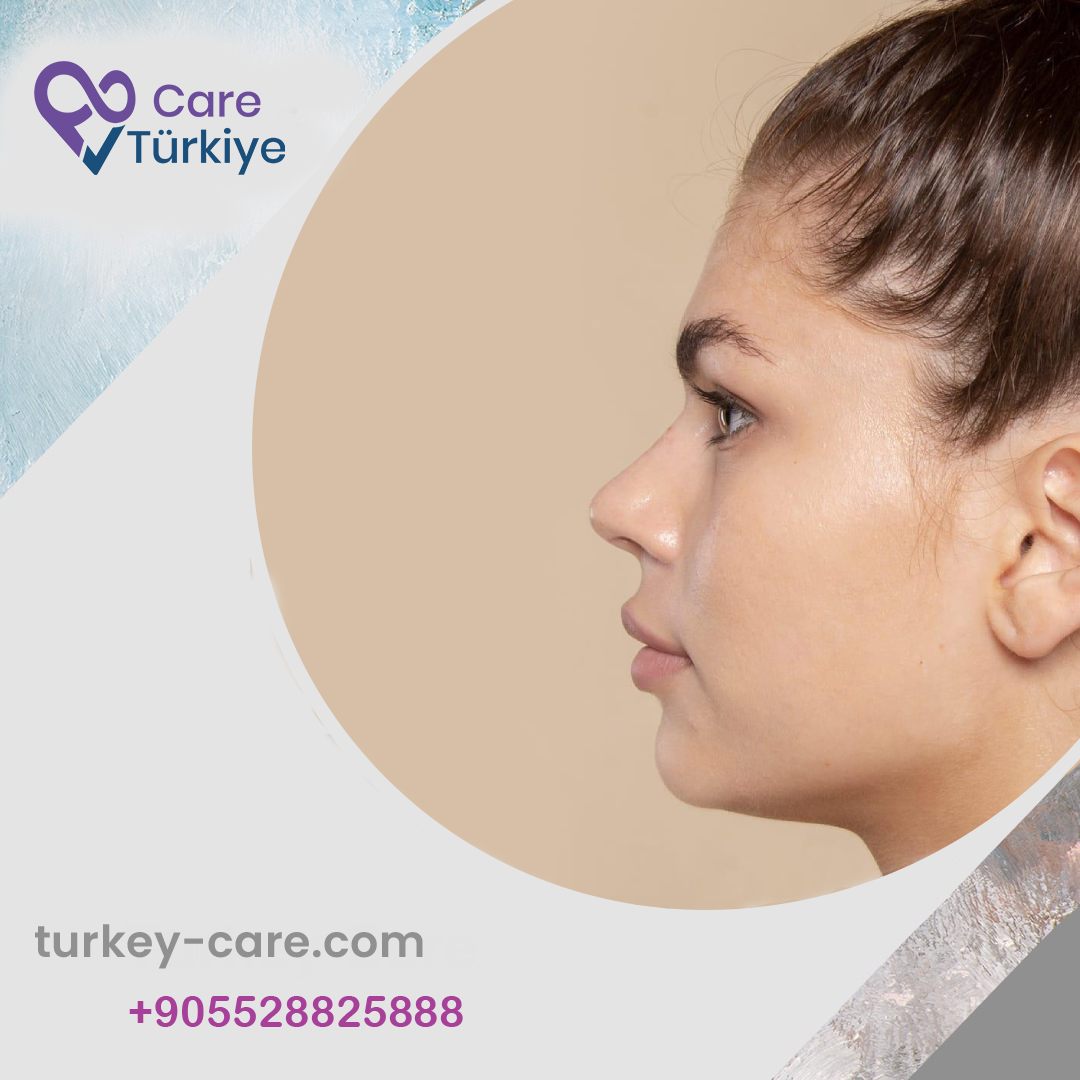 تجميل طرف الأنف